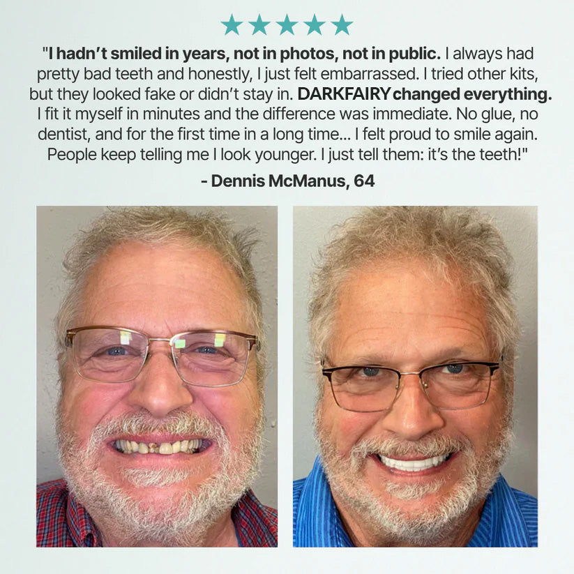 DarkFairy™ Custom-Fit Dentures — Designed for Comfort and a Natural-Looking Smile